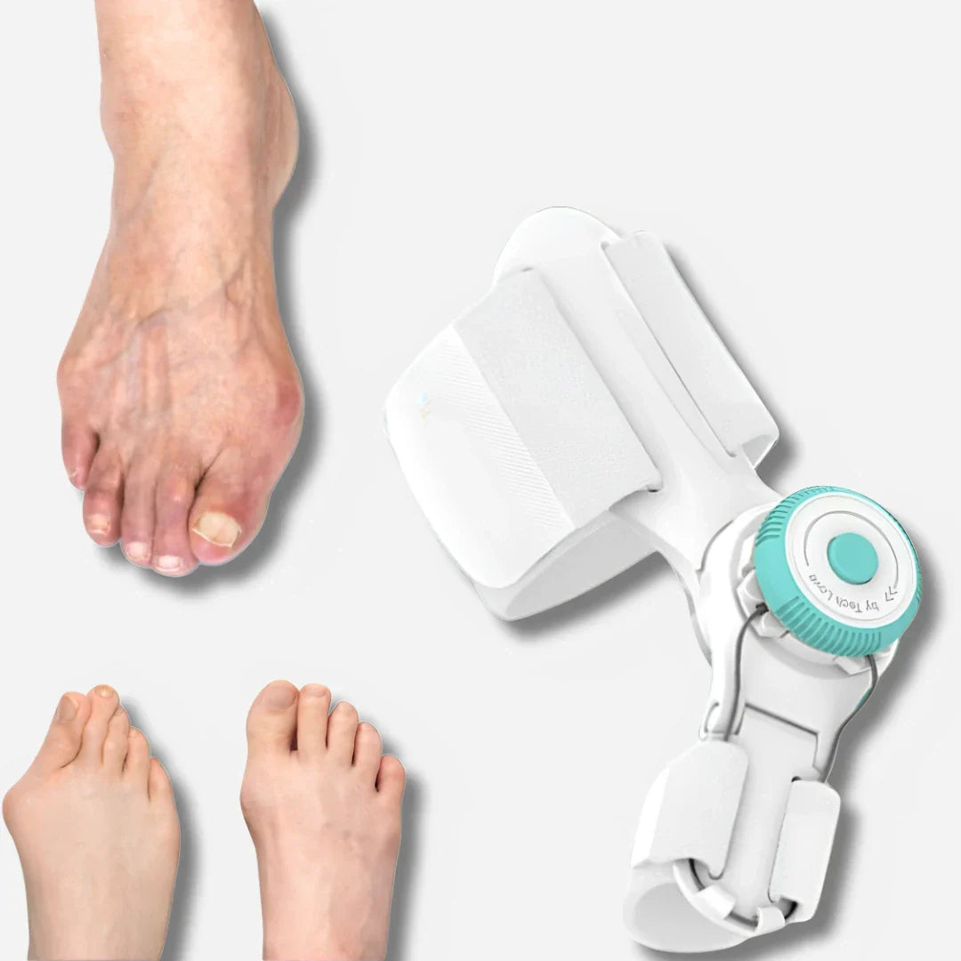 Sneakerpalace| Justerbar tåkorrektor til hallux valgus og bunion korrektion